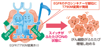 EGFRのチロシンキナーゼ部位にT790M変異が発現