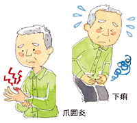 爪囲炎 下痢